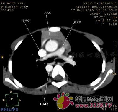 �΄�(d��ng)�}��Mխ