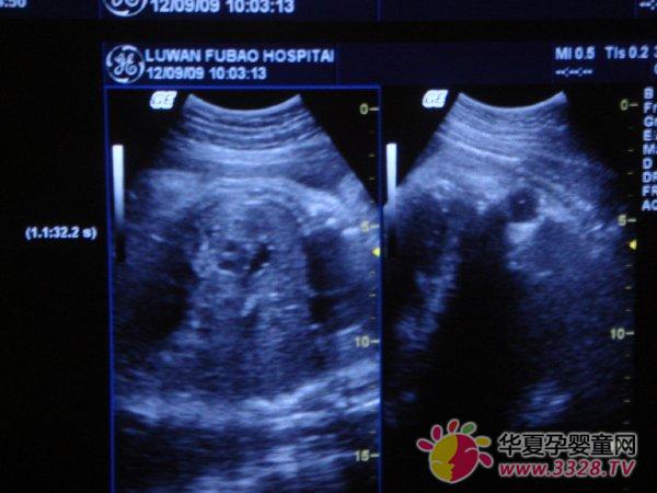 b���D��ô��